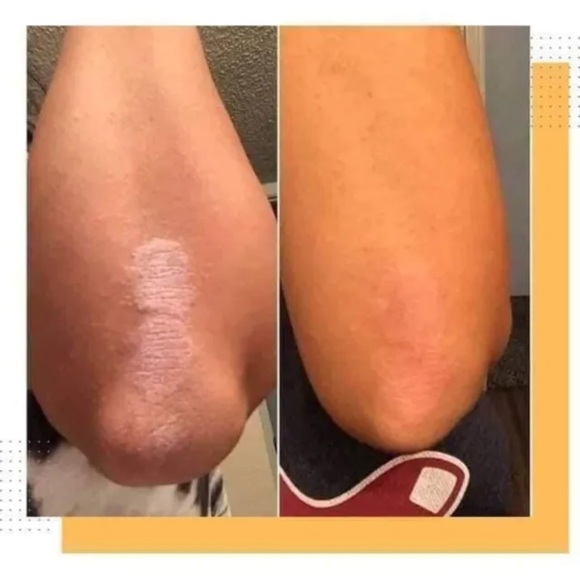 Jabón Caléndula - Picture 3 of 6